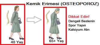 kemik-erimesi.jpg